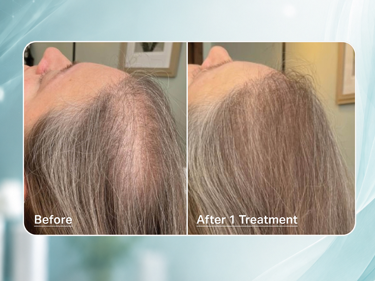 HydraScalp Before + After